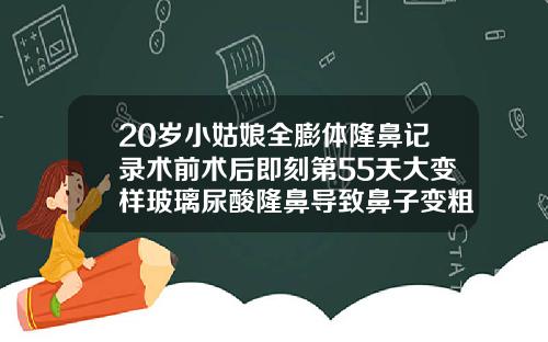 20岁小姑娘全膨体隆鼻记录术前术后即刻第55天大变样玻璃尿酸隆鼻导致鼻子变粗了